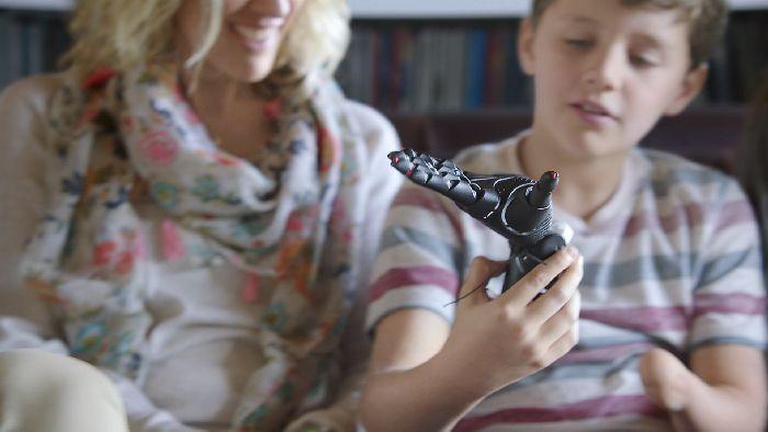 20160615 3d tisk protetika